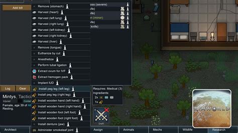rimworld leg replacement.